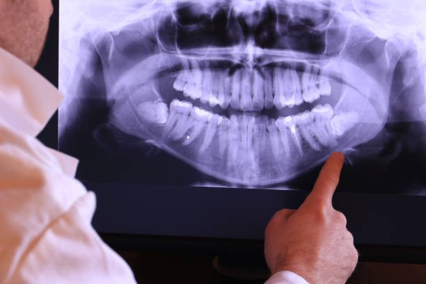 Best Emergency Tooth Extraction in Wofford Heights, CA