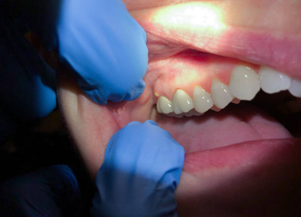 Best Emergency Treatment for Toothache in Wofford Heights, CA