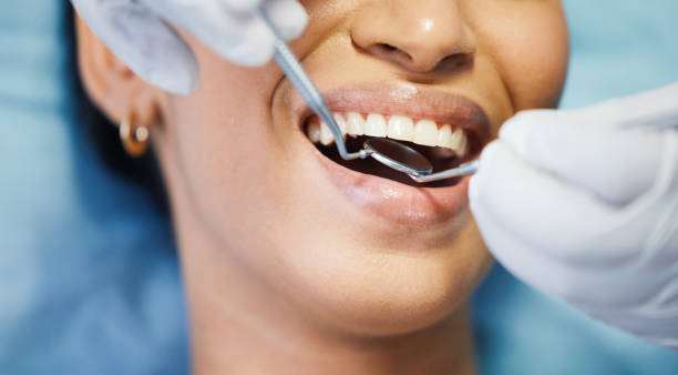 Best Emergency Tooth Extraction in Wofford Heights, CA
